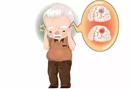 脑卒中病因有哪些？脑卒中的常见预兆有哪些？
